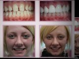Dental Implants Encino, CA - Cosmetic Dentist Encino, Woodland Hills, Tarzana CA