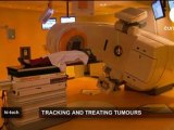 Novalis TX: Detectando y tratando tumores