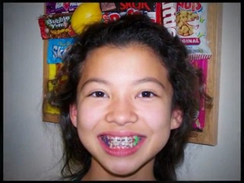 Who's the best Orthodontist in Vacaville, CA? Dr. Marino.