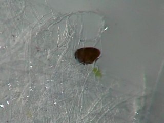 Stentor amethystinum, et Euglène ?