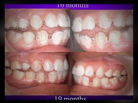 Free orthodontic exam in Fairfield with Dr. Marino