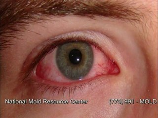 Workers Rights, Mold in the Work Place Know Your Rights