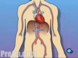 Stent Implantation Coronary Angioplasty - Body