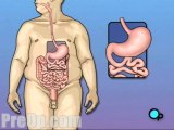 Gastric Bypass Laparoscopic Surgery - Body
