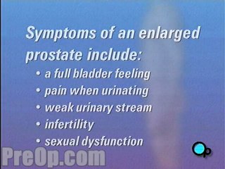 TURP Transurethral Resection Prostate - Body