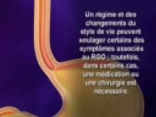 GASTRO-OBÉSITÉ-VERSION EN ARABE-Dr AMINE A