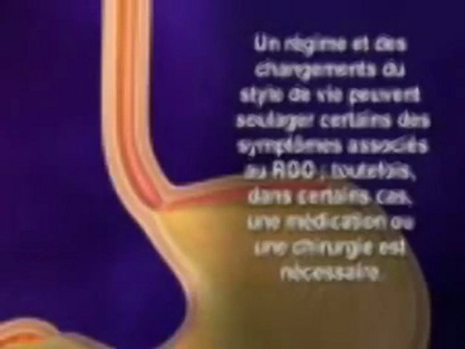 GASTRO-OBÉSITÉ-VERSION EN ARABE-Dr AMINE A
