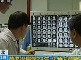 Bullet lodged in man's brain for 23 years