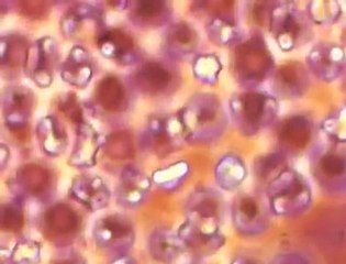 How Mosquitos Spread Malaria