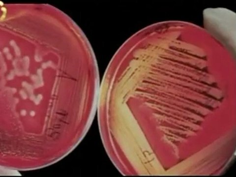 ¿Sabias que tu propia sangre puede ayudar a embellecerte de