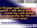 home remedies for cold sores - how to get rid of a cold sore - cold sore remedies that work fast