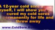 home remedies for cold sores - how to get rid of a cold sore - cold sore remedies that work fast
