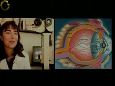 Algunos tumores cerebrales pueden tener síntomas oculares. U