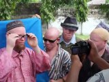 ADRA Tanzania Albino Rallies in Tanga, Moshi, and Arusha