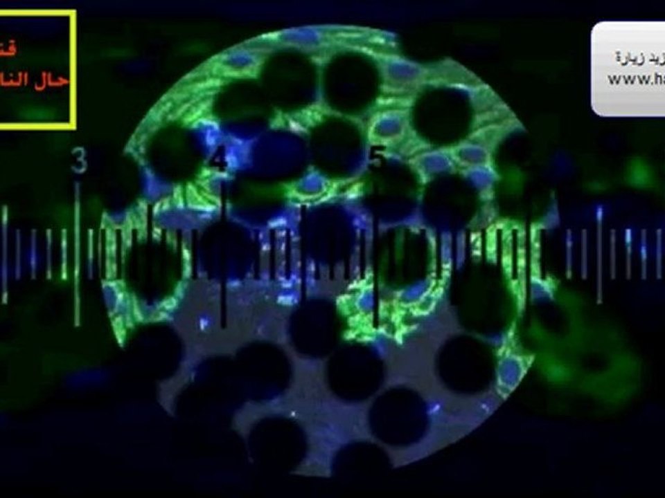 video1