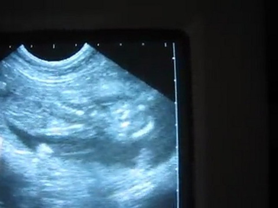 Echographie gestation chien à J38