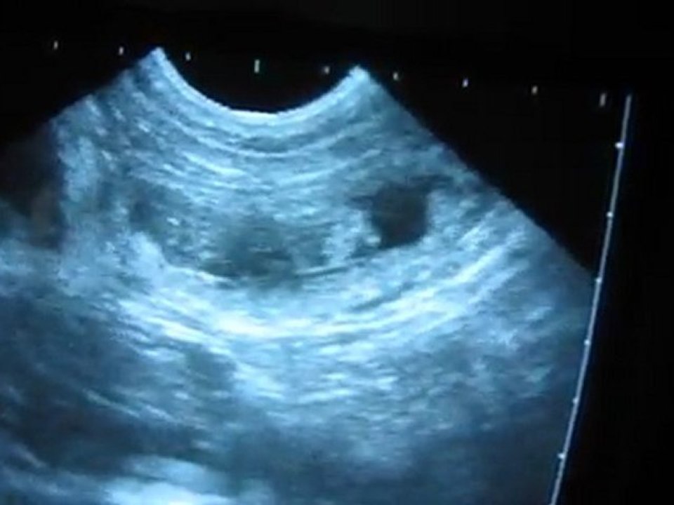 Echographie gestation chien à J35