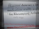 How to get rid of Rheumatoid Arthritis Symptoms and its Treatment