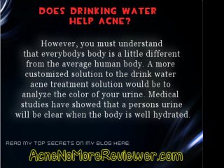 Does Drinking Water Help Acne