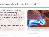 Tooth Whitening and Bleaching