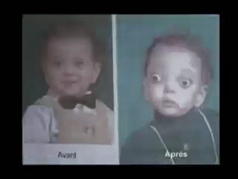 Un Scandale étouffé - Les Armes à l'Uranium Appauvri 4sur5