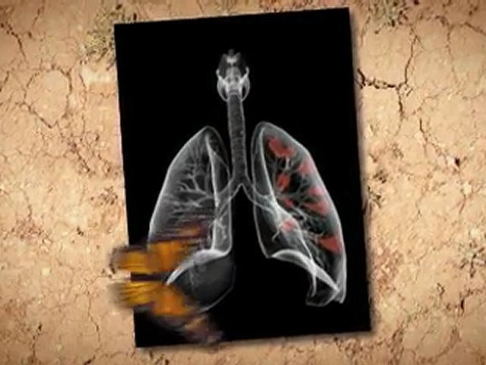 Asbestos Removal in Home Riverton