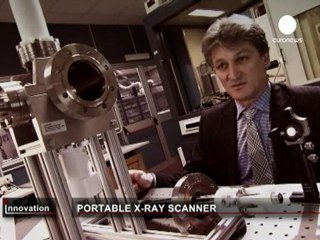 Nanoray ile röntgen cihazları her yere sığacak