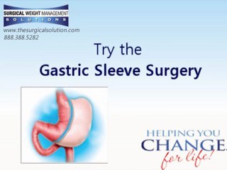 Download Video: Gastric Sleeve Dallas For Losing Weight