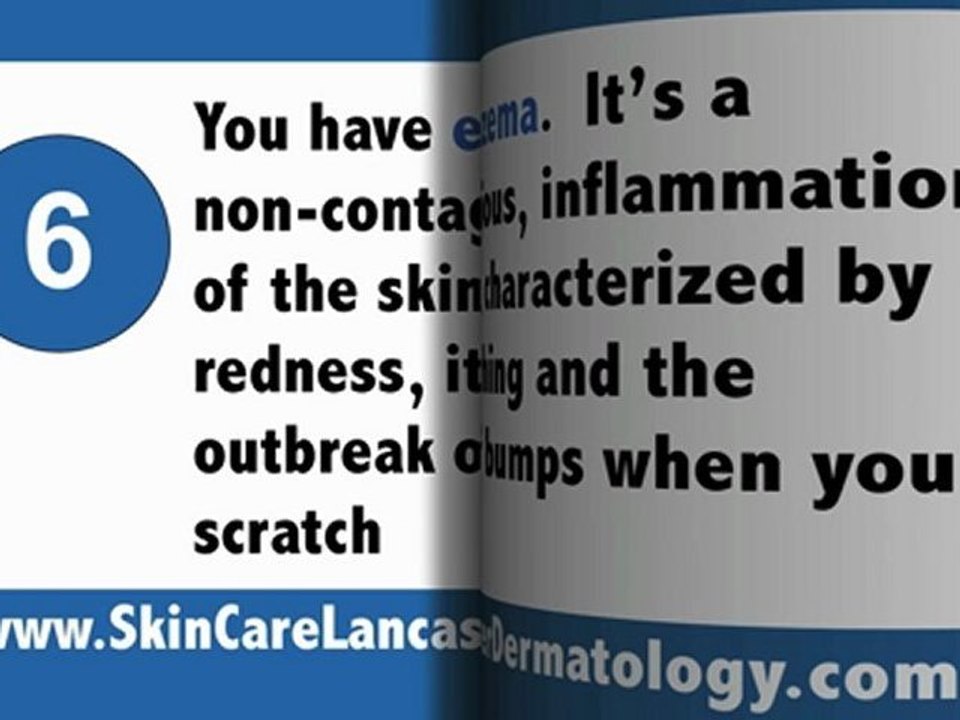 Lancaster Dermatology - Dermatology Associates of Lancaster