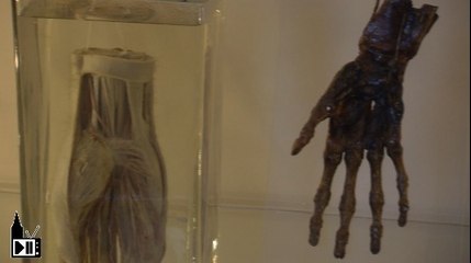 Le musée d'anatomie de Strasbourg