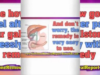 gallstone remedy - gallstone attack diet - gallstone treatment diet