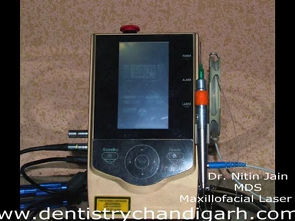 Dental Lasers guide for the patient