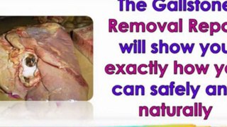 gallstone detox - gallstone home remedy - gallstone homeopathy