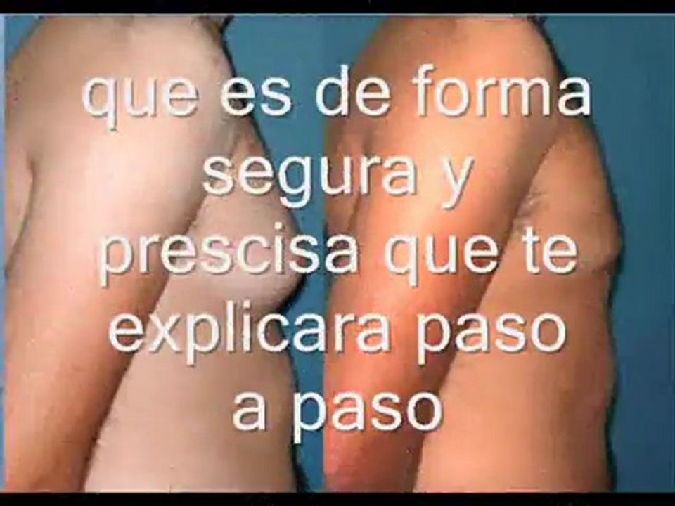 como eliminar los senos masculinos