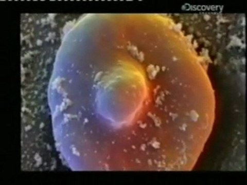 Filariasis linfatica: W Bancrofti (Parasitosis)