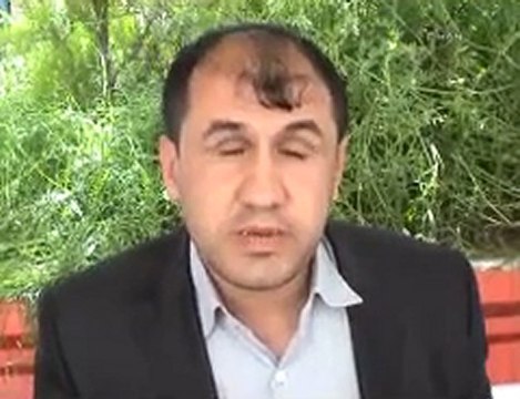 Bakan Akdağ görme engelli işçiden özür diledi!