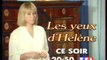 Bande Annonce de la Série Les Yeux D'héléne juin 1994 TF1