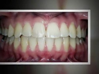 Aurora orthodontics Office - Munholland Smiles