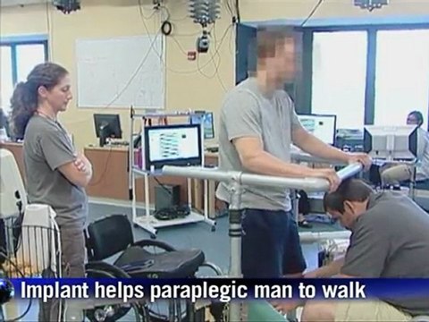 Implant breakthrough helps paraplegic man stand, walk