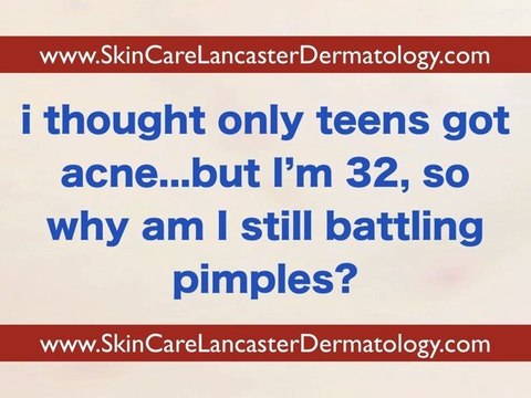 Dermatologist in Lancaster PA - Acne