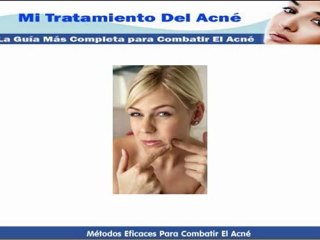 Tipos De Acne