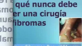 fibromas en el embarazo - miomas uterino - mioma de utero