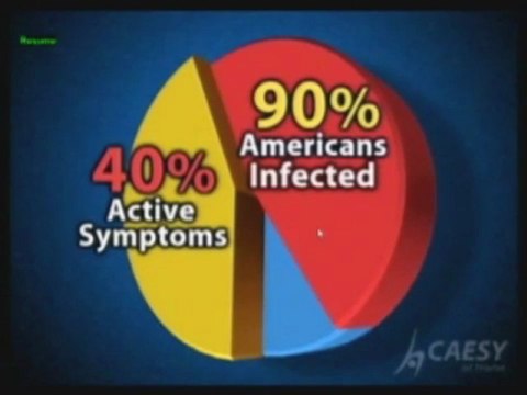 What is a Cold Sore? By Kamran Sahabi Dentist Glendale, CA