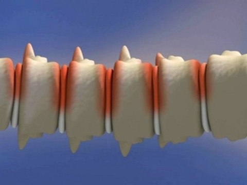 husler nest chez Vepi