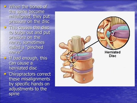 Knoxville Chiropractor, Nathan Leavitt DC Explains Chiropractic