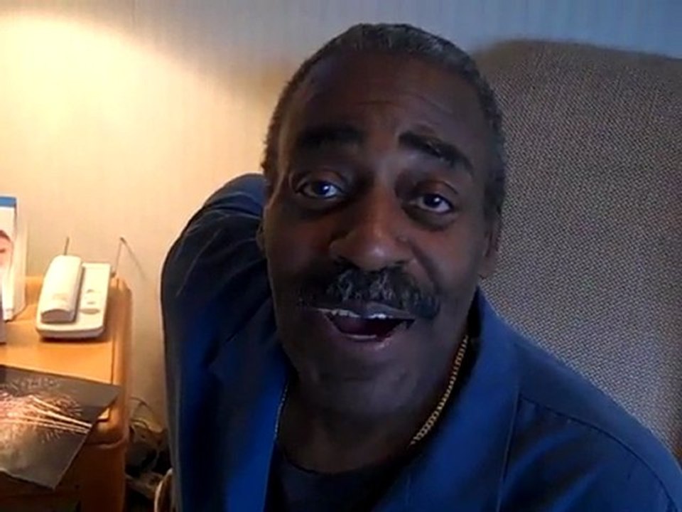 Porcelain Dental Veneers Patient Results Millburn New Jersey