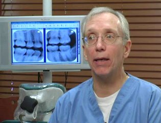 Best Dental Fillings    www.SmilesofSkokie.com