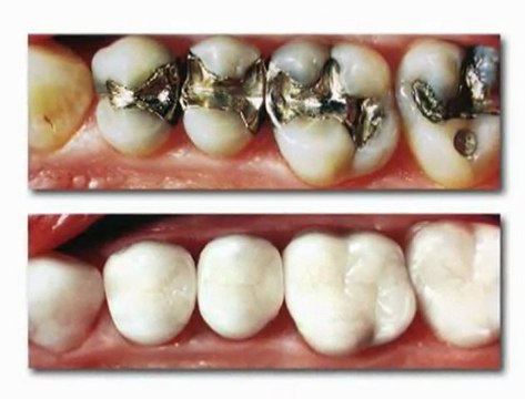 Dentist in Skokie, IL SmilesOfSkokie.com