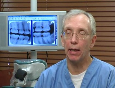 No Drill dental fillings SmilesofSkokie.com