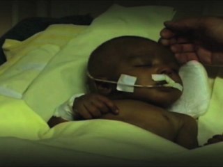 Présentation La Chaîne de l'Espoir